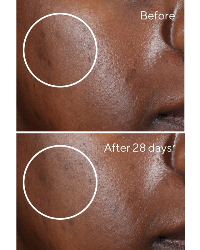 RAPID DARK SPOT CORRECTING SERUM