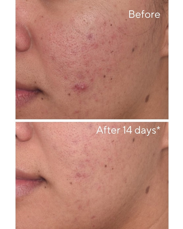 RAPID DARK SPOT CORRECTING SERUM
