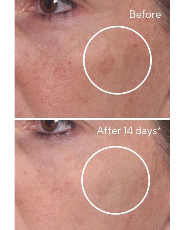 RAPID DARK SPOT CORRECTING SERUM