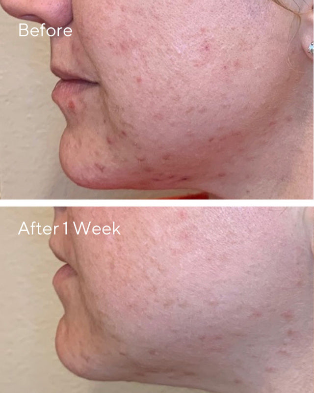 DAILY CLARIFYING PEEL