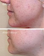 DAILY CLARIFYING PEEL