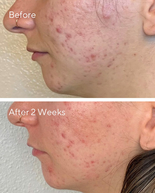 DAILY CLARIFYING PEEL