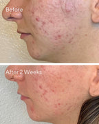 DAILY CLARIFYING PEEL