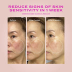 Heartleaf Gentle Resurfacing Serum