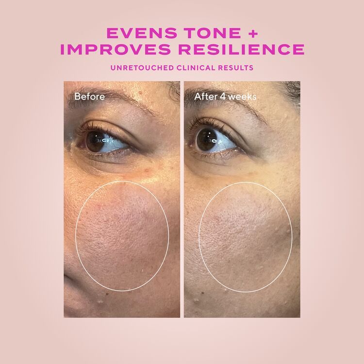 Heartleaf Gentle Resurfacing Serum