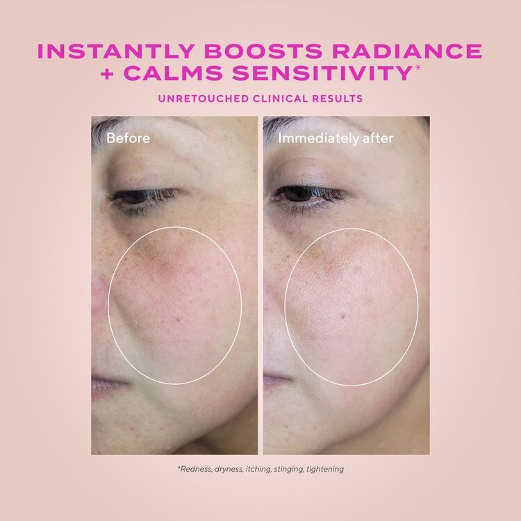 Heartleaf Gentle Resurfacing Serum