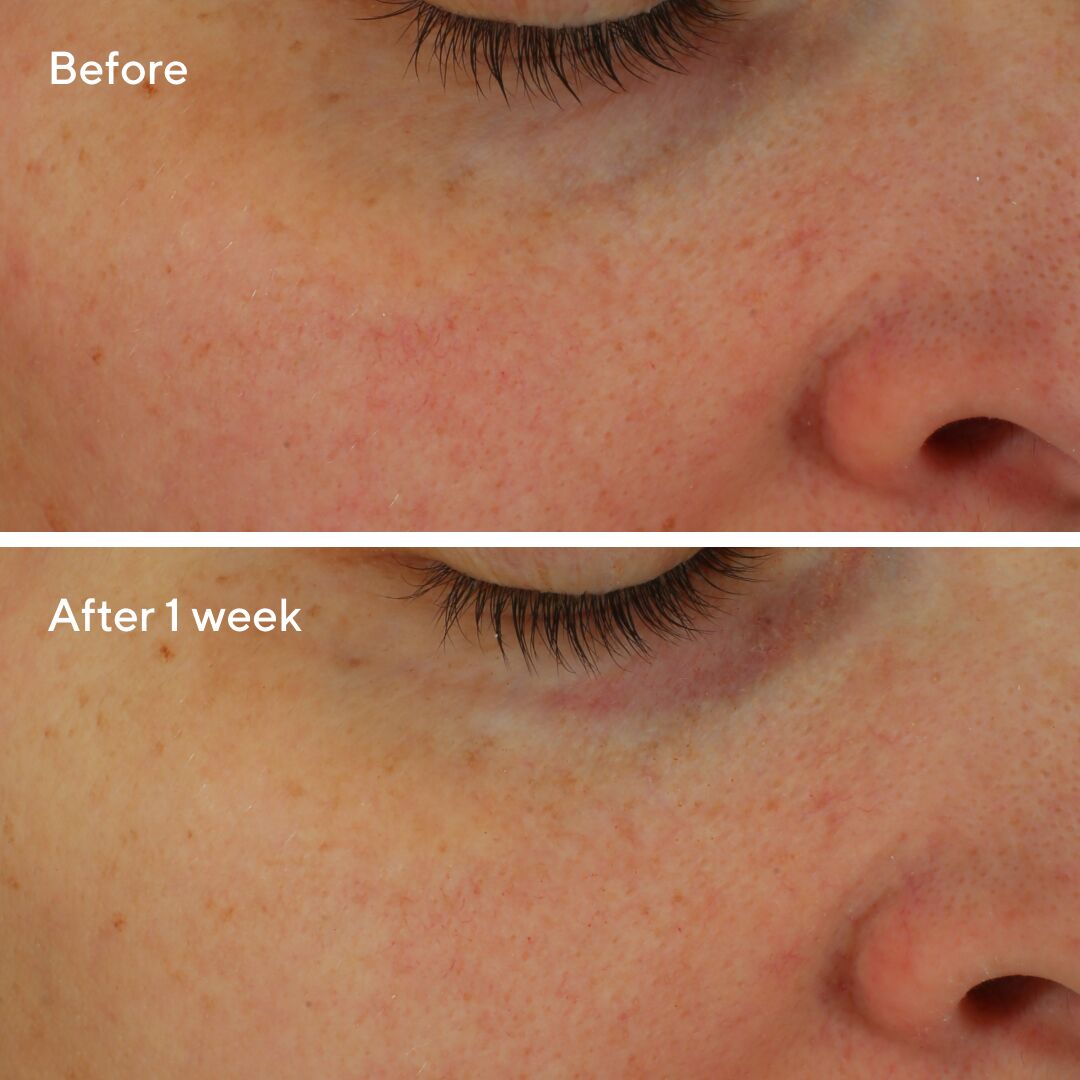 Restorative Hydro-Hyaluronic Cream